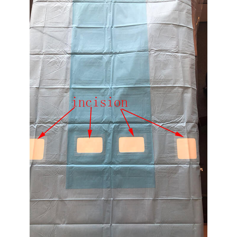 Angiography sterile drape for Hospital | Medical Drapes Manufacturer