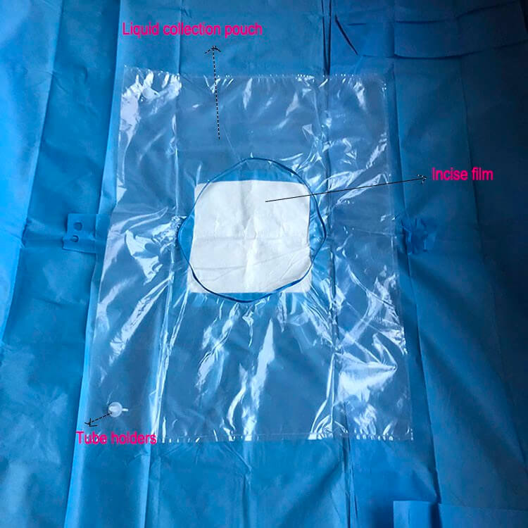 clear curtain c section sterile drape for cesarean procedure